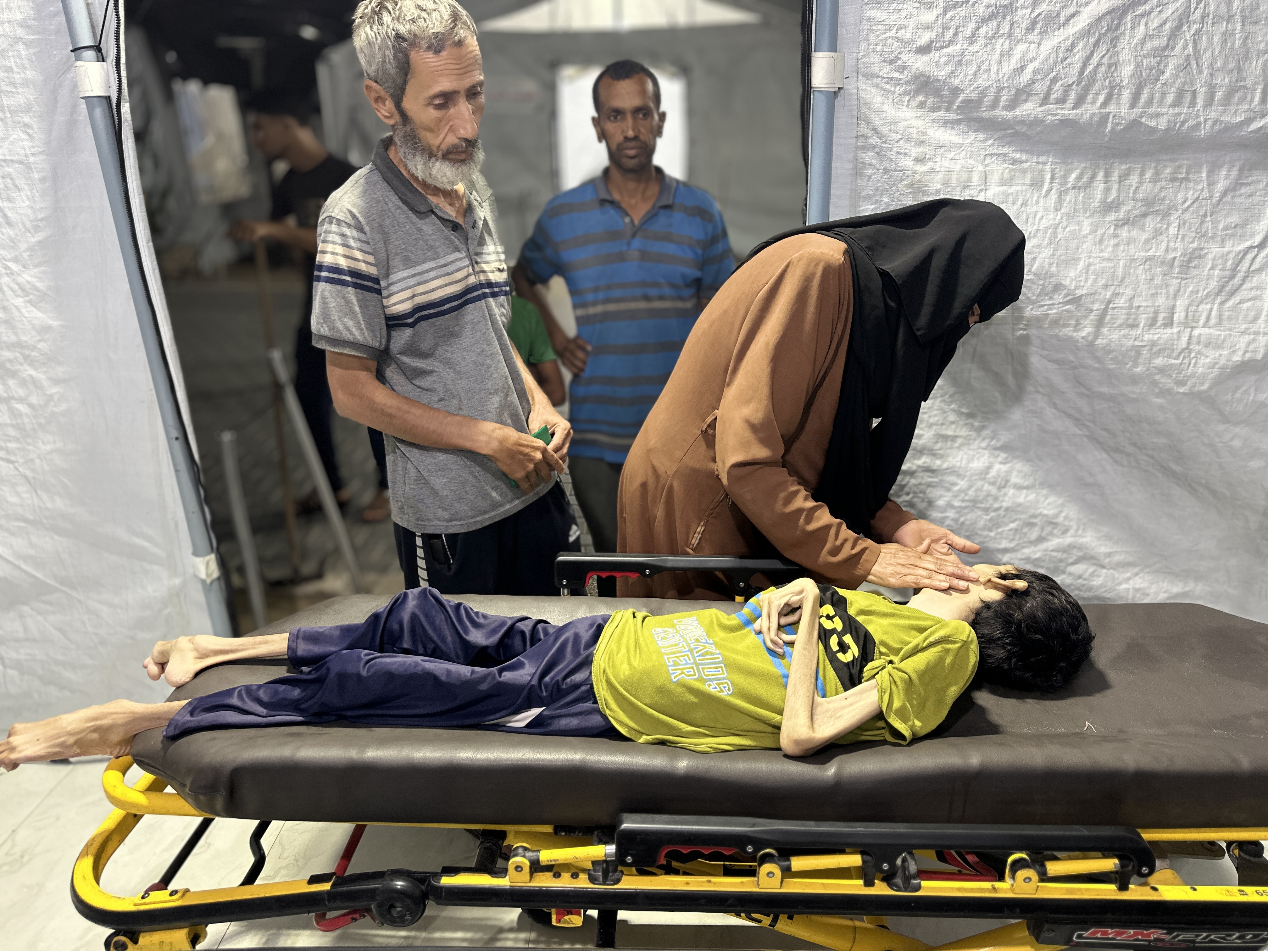 Han Yunus'ta yetersiz beslenme sorunu yaşayan 29 yaşındaki Eyüp Sabır Ebu el-Hasin