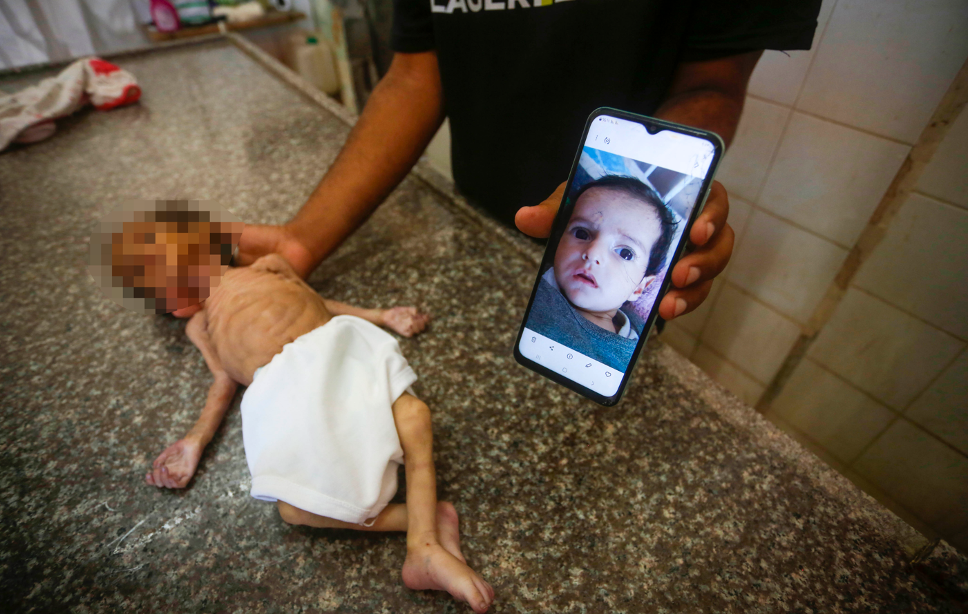 3 aylık Gazzeli bebek Jodi el-Masri