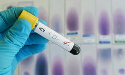 2024'te 1,3 milyon kişi AIDS hastalığına yakalandı