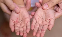 ‘Sessiz tehlike’ yayılıyor: Uzmanlardan kalabalık ortam uyarısı