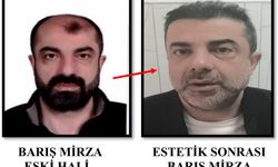 Ameliyat ile yüzünü değiştirdi 7 yıl sonra yakalandı