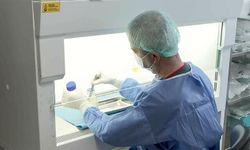 Deri bankası yanık tedavisinde önemli rol oynuyor