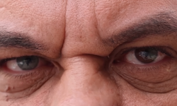 3 renkli gözleri, görenleri şaşkına uğrattı!