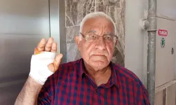 En sevdiği komşusu parmağınını ısırarak kopardı