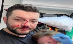 Kucağında bebeği olan babayı darp eden saldırgan serbest bırakıldı