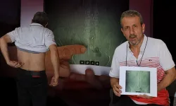 Belindeki ağrılar dinmeyince gerçek ortaya çıktı