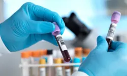 Avustralya'da kanser alarmı: 2050'de 2,6 milyon kişi kanserle yaşayacak