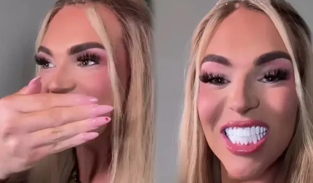 890 bin lira harcadığı dişleri alay konusu oldu!