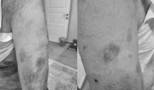 Cenaze dönüşü darp edildi: "Çift görüyorum, şikayetçiyim"