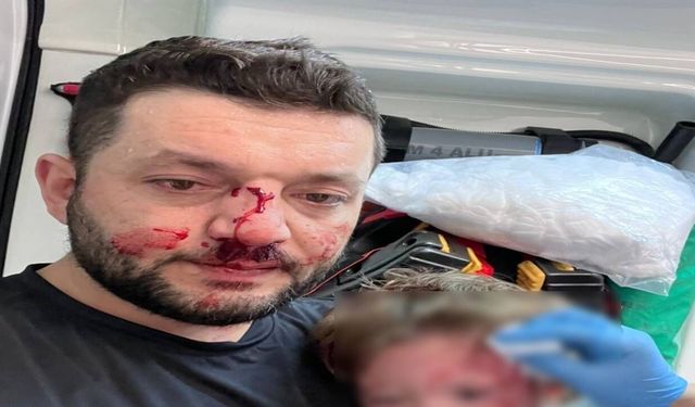 Kucağında bebeği olan babayı darp eden saldırgan serbest bırakıldı