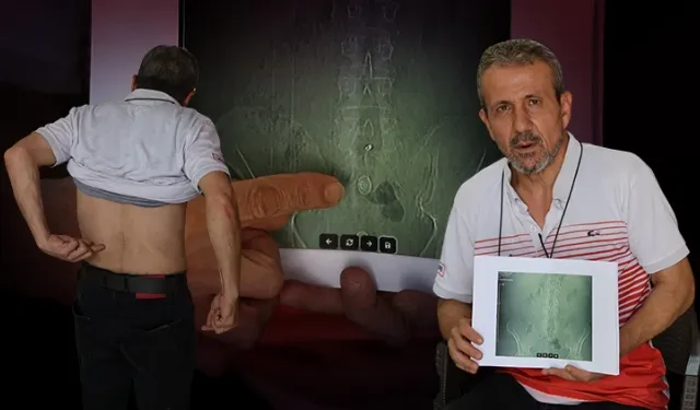 Belindeki ağrılar dinmeyince gerçek ortaya çıktı