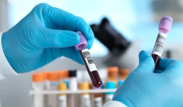 Avustralya'da kanser alarmı: 2050'de 2,6 milyon kişi kanserle yaşayacak