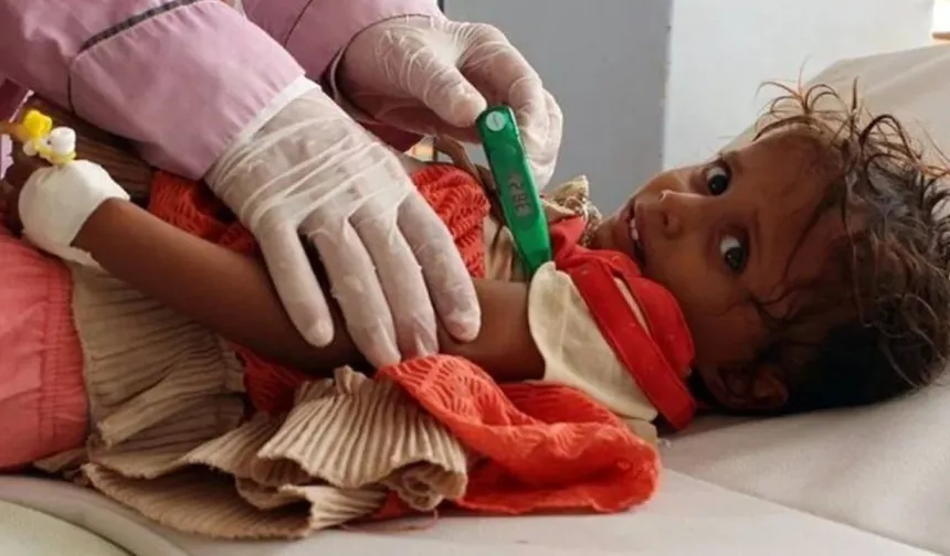 UNICEF: Sudan'da 1 milyondan fazla çocuk kolera riski altında