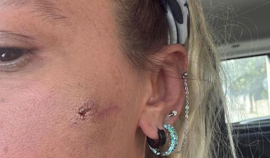 Ünlü oyuncudan şok eden iddia: ‘Eşim beni darp etti'