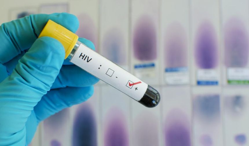 2024'te 1,3 milyon kişi AIDS hastalığına yakalandı