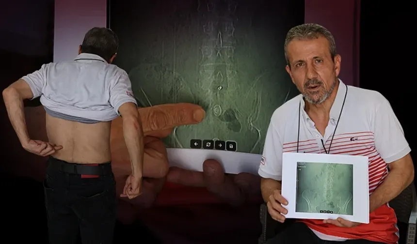 Belindeki ağrılar dinmeyince gerçek ortaya çıktı